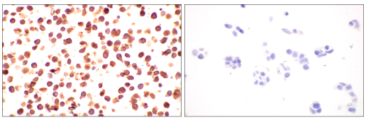 老化およびがん研究のためのIHC検証済みp16 INK4A Antibody 老化およびがん研究のためのIHC検証済みp16 INK4A Antibody
